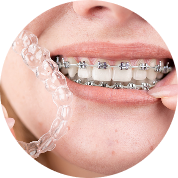 Orthodontics