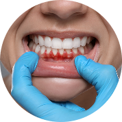 Periodontics